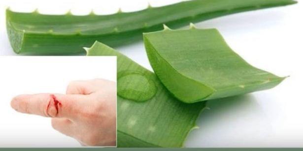 Aloevera for wounds