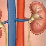 10 essential ways for a healthy kidney