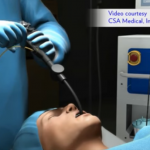 ক্রায়োসার্জারি/Cryosurgery